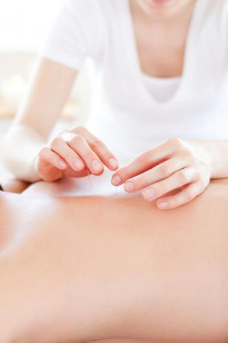 close-up of a youngman in an acupuncture therapy